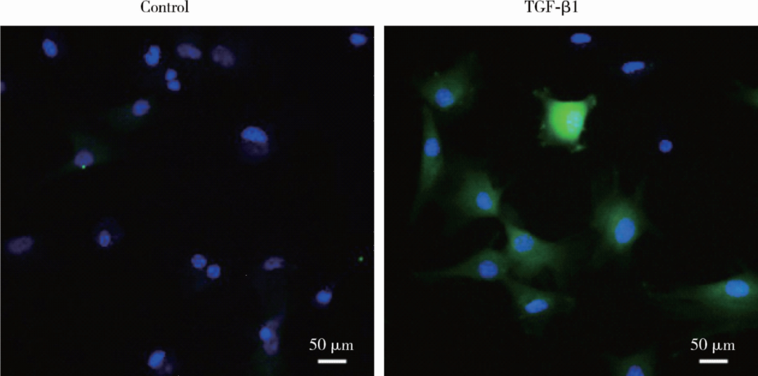 yl23455永利官网重组人TGF-β1蛋白
